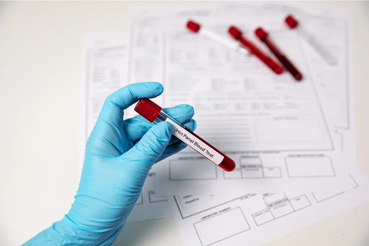 Iron Panel Blood Test: 7 Key Facts Explained