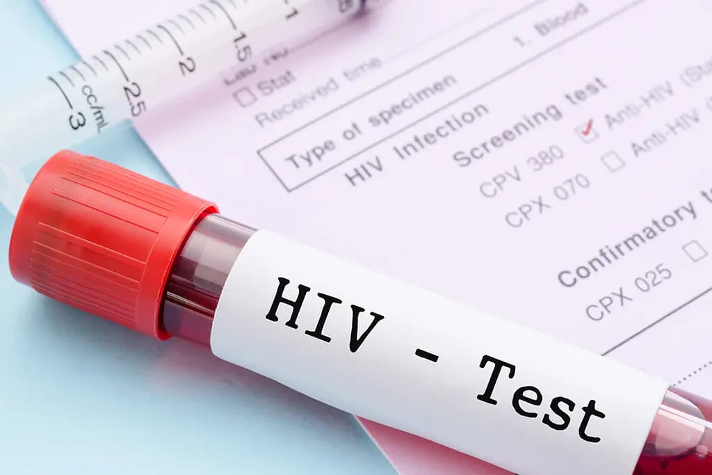 Understanding the Accuracy of HIV Early Detection Tests