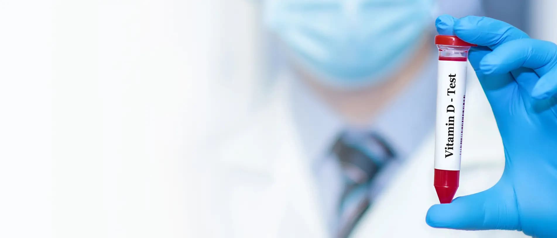 Vitamin D Blood Test