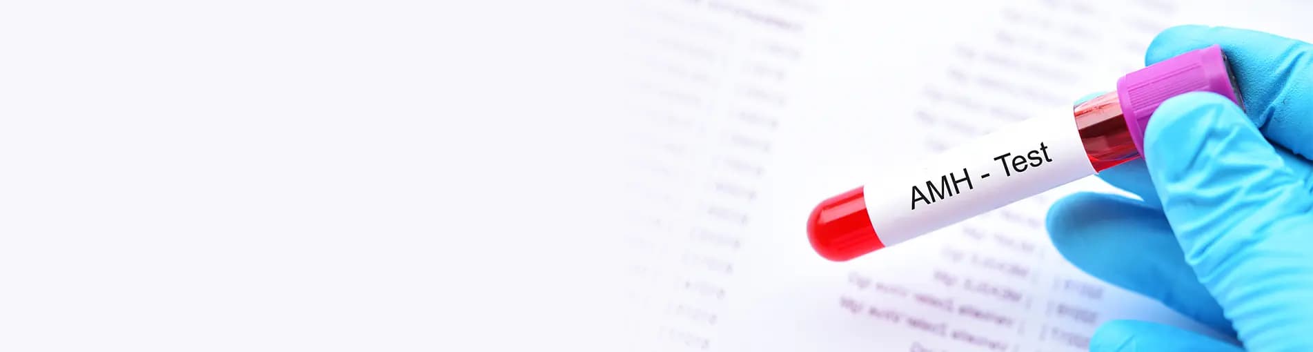 Antimullerian Hormone Test