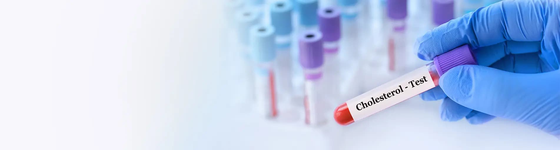 Lipid Profile