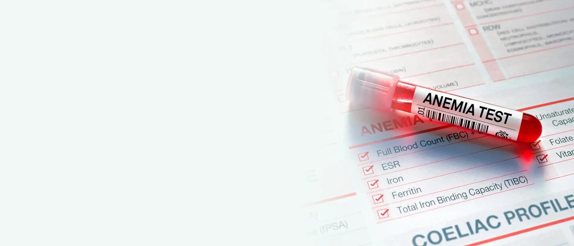Anaemia Profile Blood Test