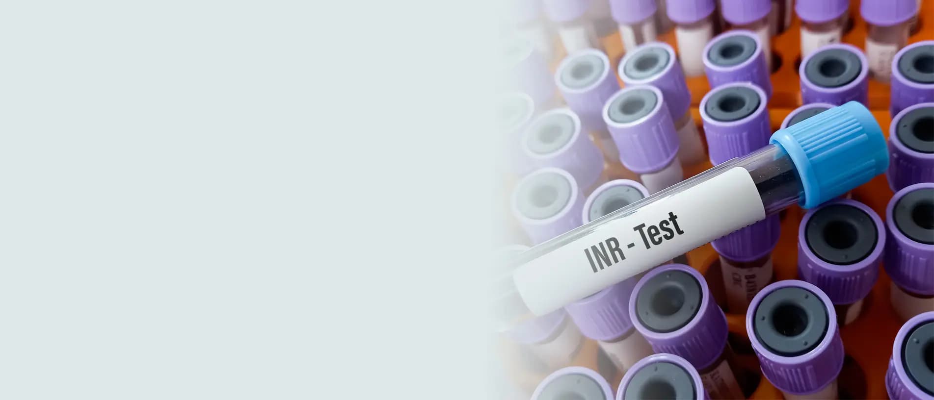 INR Test